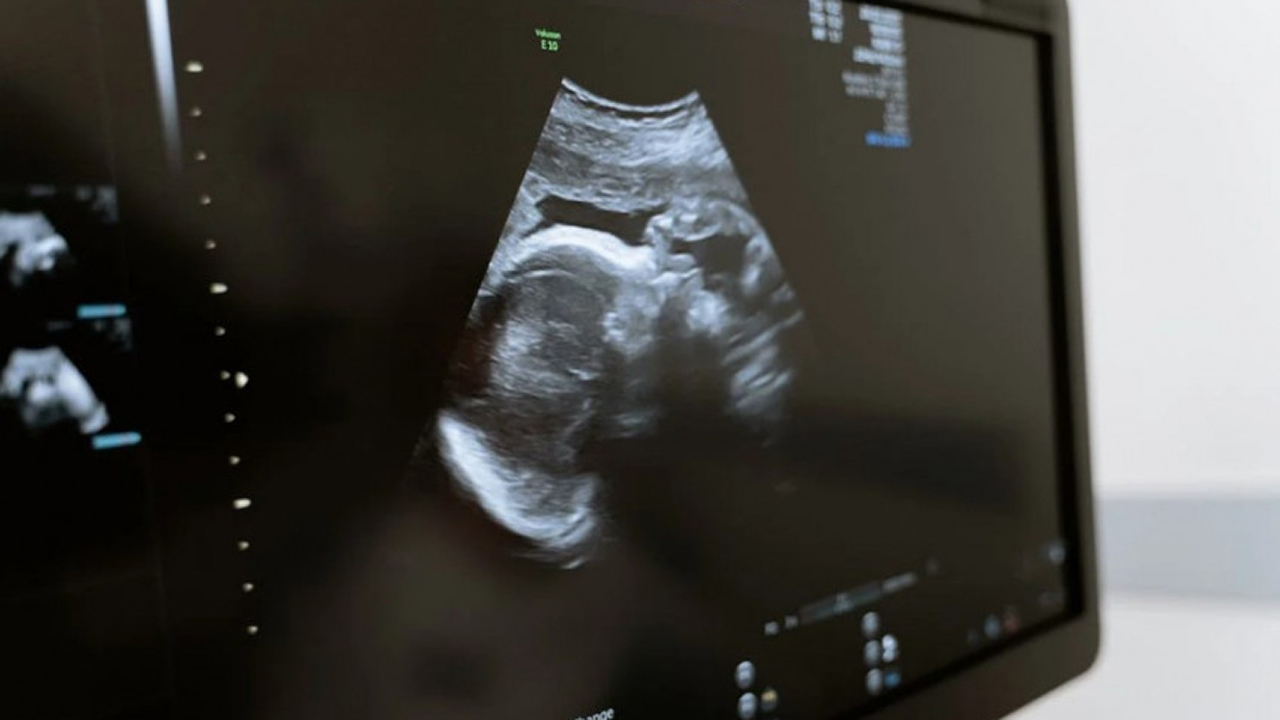 Szívhang – Szeptember 15-től megváltozik hazánkban az abortusz szabályozása